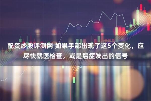 配资炒股评测网 如果手部出现了这5个变化，应尽快就医检查，或是癌症发出的信号
